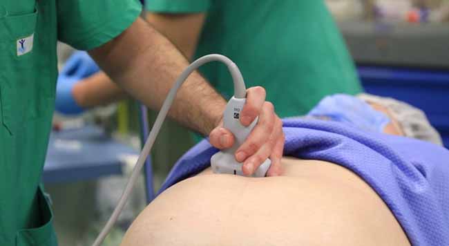 intervento all'ospedale bambin gesù a roma